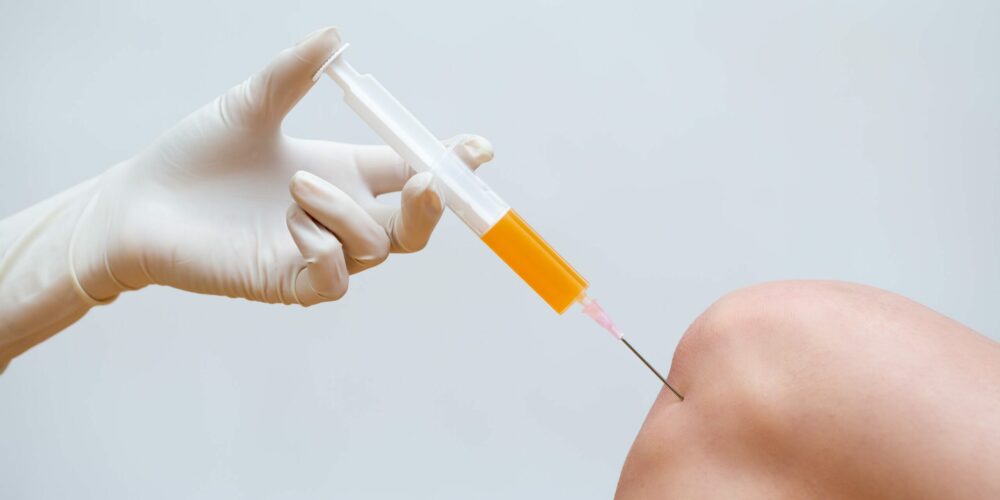 Doctor doing stem cell therapy on a patient knee after the injury using syringe with needle. Treating joint pain with platelet-rich plasma injection. Treatment of arthritis and osteoarthritis.